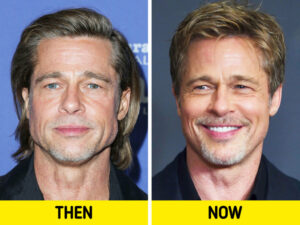 Descubra Bichectomia Masculina: Antes e Depois da Cirurgia