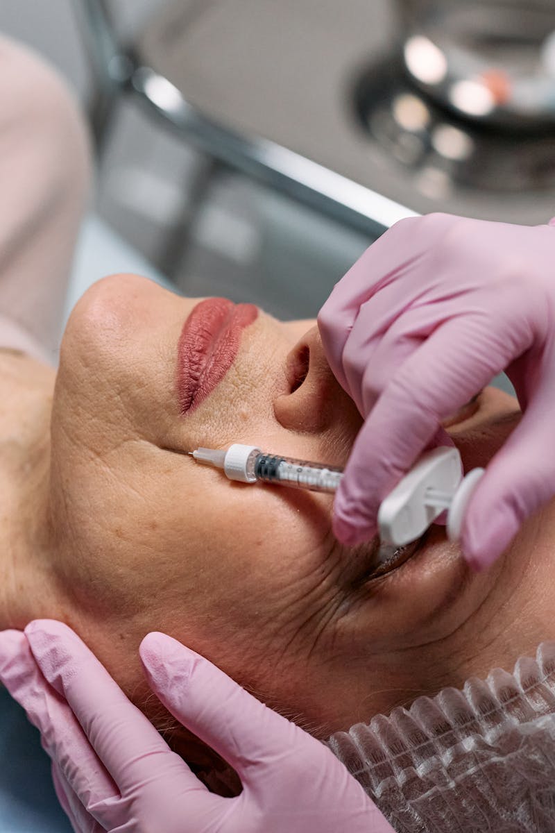 O que é toxina botulínica com antes e depois de resultados na estética facial feminina