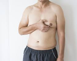 Sintomas precoces da ginecomastia