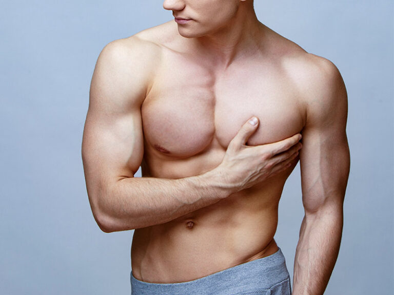 Entenda os Sintomas da Ginecomastia Masculina e Como Tratá-la