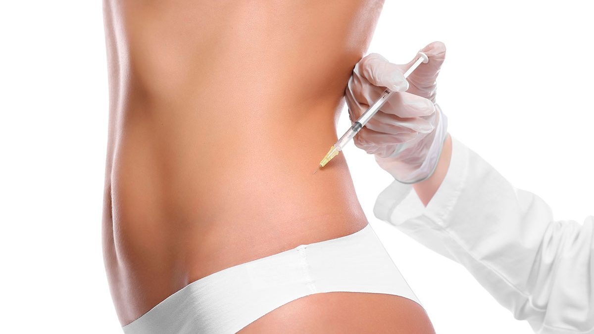 resultado de O paciente fez Lipoaspiração Enzimática 